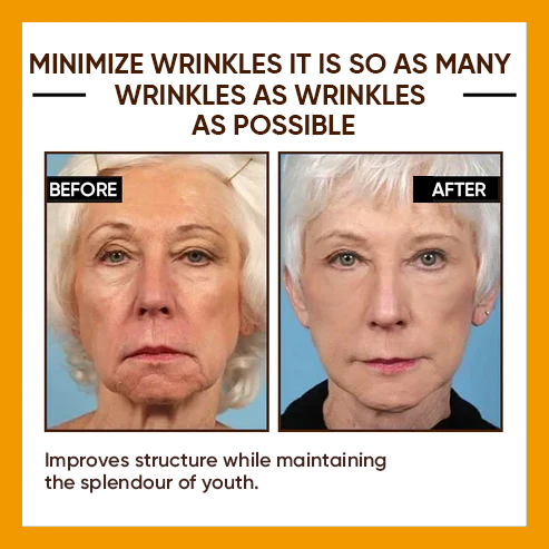 🔥Full refund if no effect after use🔥2024, Exclusive premium COMPLEX technology and sophisticated design 2-minute wrinkle-reducing serum（ ✅ Permanently removes wrinkles in 3 minutes ✅ ）