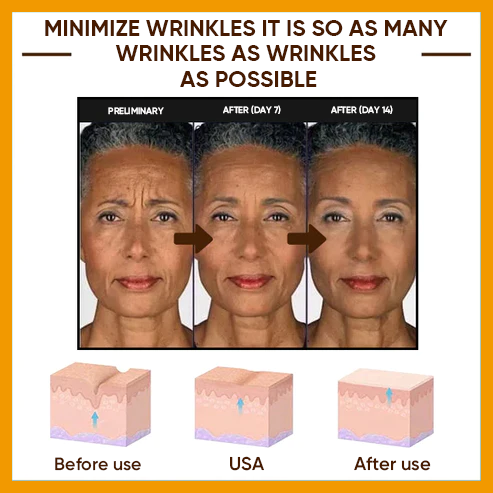 🔥Full refund if no effect after use🔥2024, Exclusive premium COMPLEX technology and sophisticated design 2-minute wrinkle-reducing serum（ ✅ Permanently removes wrinkles in 3 minutes ✅ ）