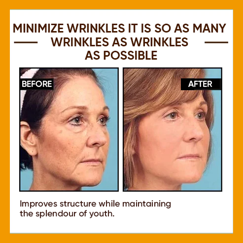 🔥Full refund if no effect after use🔥2024, Exclusive premium COMPLEX technology and sophisticated design 2-minute wrinkle-reducing serum（ ✅ Permanently removes wrinkles in 3 minutes ✅ ）